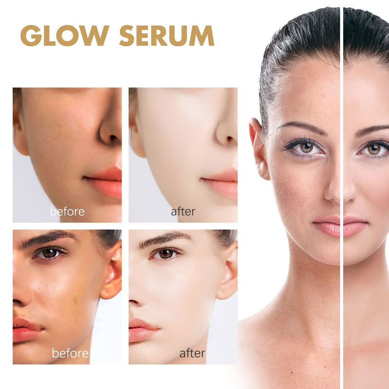 EELHOE Propolis Niacinamide Facial Essence before and after acne mark reduction results