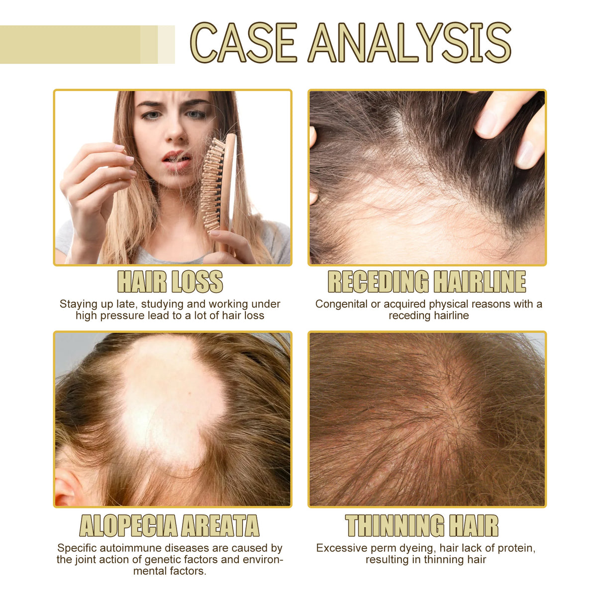 Rosemary Hair Growth Oil  by EELHOE– Coffee & Argan Nourishing Scalp Treatment for Thicker Hair